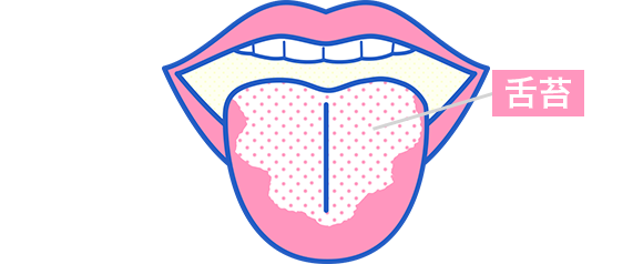 知ってた 口の中に苔が生えるなんて 口臭の原因 舌苔とは 口臭科学研究所