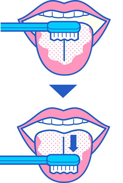 知ってた 口の中に苔が生えるなんて 口臭の原因 舌苔とは 口臭科学研究所